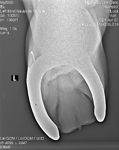 Luna Radiographs0005